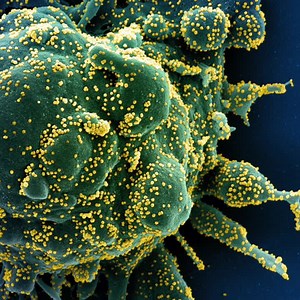 2.5M views · 159 reactions | This is what we currently know about the COVID-19 Delta variant ⬇️ World Health Organization (WHO) | UN Geneva | Facebook