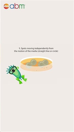 Cell Culture Contamination: What to Watch For