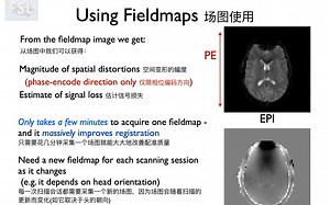 影像炼金第21弹：场图（fieldmap）原理及两种校正方法