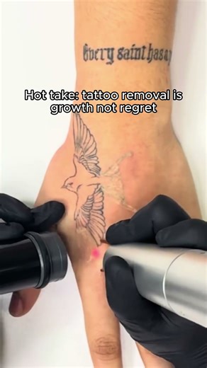 The Truth About Tattoo Removal You Didn’t Know