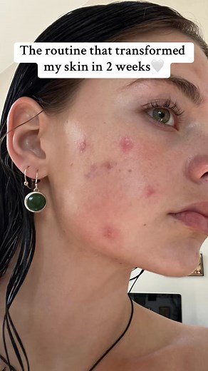 Summer glow up skincare routine that'll change your whole appearance懶 - @Anua Store US #anua #glassskinroutine #Koreanskincare #cloggedpores #doublecleansing #acnescars #dealsforyoudays | Sandra Moore | Facebook