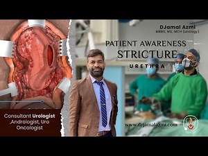 Stricture Urethra - Awareness regarding Symptoms, Diagnosis and Treatment | Dr. Jamal Azmi