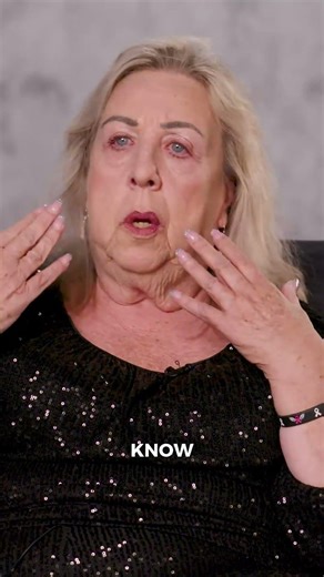 Cystic Acne & Acne Scars Treatment with The Perfect Derma Peel | Douglasville GA Med Spa