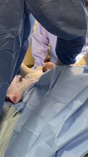 Una cría de gorila llamada Jameela nació prematuramente por cesárea en un zoológico de Texas, tras complicaciones graves. Tanto la madre como la cría sobrevivieron. A veces, una cesárea no solo permite el nacimiento… también salva dos vidas.