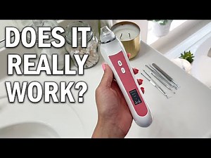 Blackhead Remover Vacuum Review - Does It Really Work?