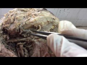 Anterior triangle of neck