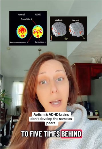 Understanding the Prefrontal Cortex in ADHD and Autism
