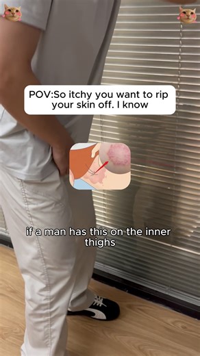 Scratching makes it worse? You don’t need to spend a fortune to feel relief. #ItchySkin#RedSpots#ringworm#SkincareTips#TikTokShopBlackFriday