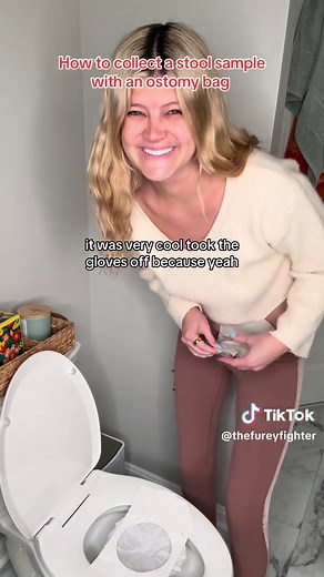 How to Collect a Stool Sample with an Ostomy Bag
