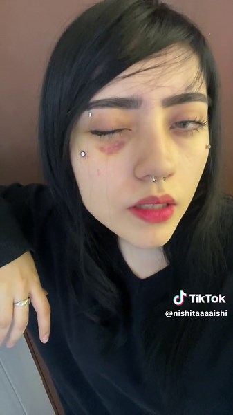 🗣️ #fyp #piercing #tattoo #microdermal | microdermal