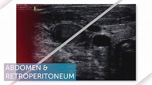 Become an ultrasound expert and learn how to correctly image pediatric patients. Start with Free Video Lectures now! | 123sonography