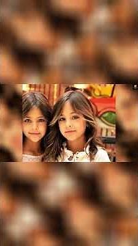Most Beautiful Twins in the World Then vs Now… The Truth Will Shock You