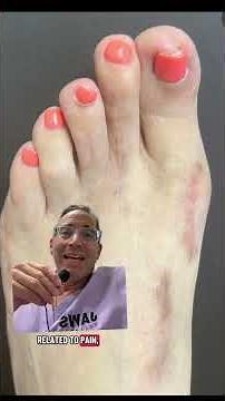 PLEASE DO YOUR HOMEWORK!🗣️‼️⚠️#shorts #bunionsurgery