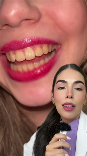 Dientes Blancos: ¿Son Naturales? Mitos y Realidades