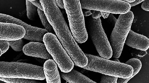 Health department investigates E. coli outbreak linked to Japanese restaurant in Bellevue