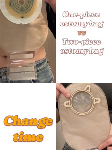 When to Change Your One-Piece vs. Two-Piece Ostomy Bag