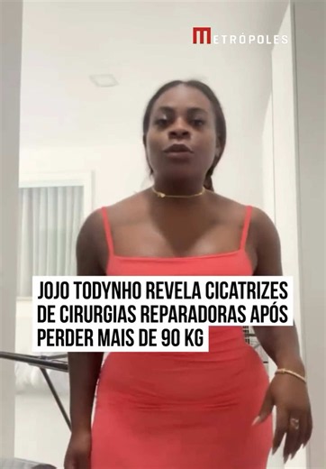 Jojo Todynho revelou como estão as cicatrizes das cirurgias reparadoras que realizou para remover o excesso de pele após o processo de emagrecimento. Nos stories do Instagram, a ex-funkeira mostrou as marcas dos procedimentos, que vão da região das axilas até abaixo dos sei0s. A famosa realizou uma cirurgia bariátrica em agosto de 2023 para tratar a obesidade mórbida e já perdeu mais de 90 kg. #Metrópoles 🤳 Reprodução