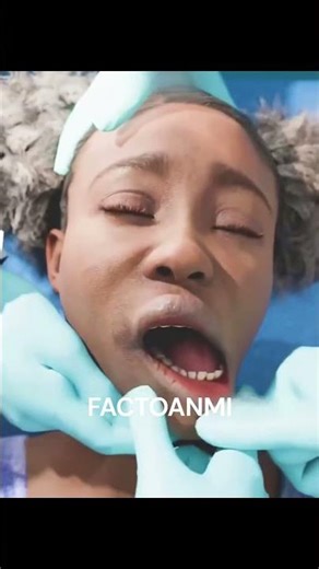 😱 Jabda (Jaw) khula hi reh gaya! 🦷 #Shorts