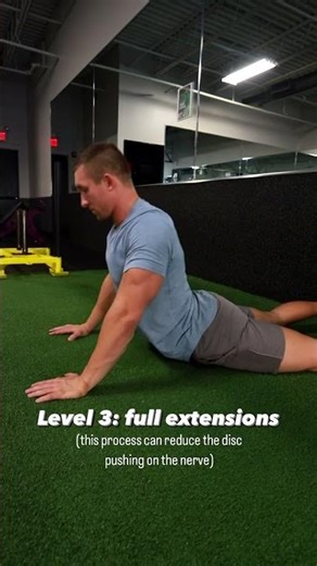 STOP Stretching Sciatica! Do This Instead