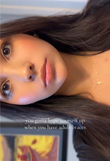 girlies with adult braces are the baddest ! I don’t make the rules 🙅🏽‍♀️ on a serious note i used to be insecure about them—especially when they gave me a lisp for months LOL but we overcame that challenge & now Im lisp free😂🩵 #braces #relateable #20something