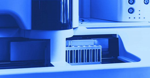 Taux de gamma-GT élevé : quelles causes ?