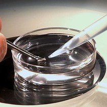 Video: Ex vivo Method for High Resolution Imaging of Cilia Motility in Rodent Airway Epithelia