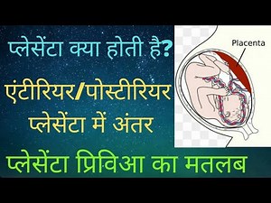 Placenta क्या होती है? | Anterior/Posterior प्लेसेंटा में अंतर | प्लेसेंटा प्रिविआ का मतलब