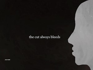 155K views · 8.1K reactions | The cut that always bleeds | 홅홚홟홚 홈홤홤홙 | Facebook