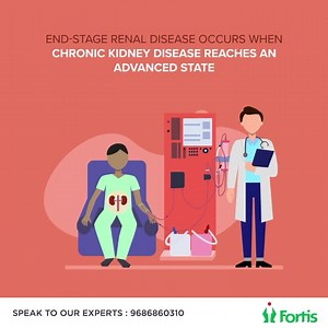 End-Stage Renal Disease (ESRD) is a medical condition in which a...