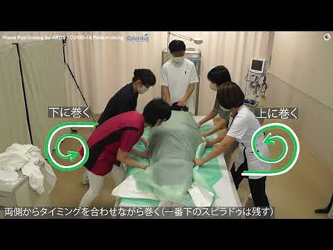 スピラドゥを使用したARDS/COVID-19 患者の腹臥位への体位変換例