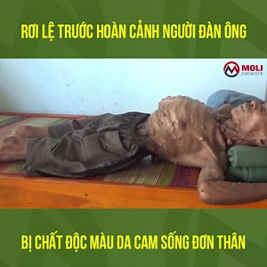 2.7M views · 10K reactions | Xót Thương Người Đàn Ông bị chất độc màu da cam sống đơn thân ở Quảng Nam. Chú Võ Tấn Hùng, Địa chỉ nhà chú, Đội 1, Thôn 5, xã Tam Thành, H. Phú Ninh, Tỉnh Quảng Nam. Cre: Cuộc Sống Miền Trung | Lời vàng ý ngọc | Facebook