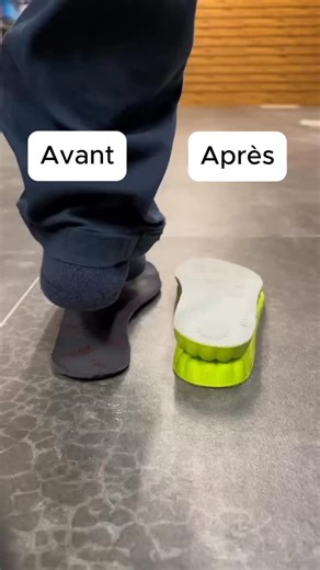 Brigade Antirouille on Instagram: "👣 Tu as les pieds qui s’écrasent, une mauvaise posture ou des douleurs en marchant ? Regarde cette transformation AVANT / APRÈS 😳 💬 Commente "SEMELLE" pour recevoir le lien de la semelle + un code promo exclusif 🎁 Sur la vidéo, la différence est flagrante. À gauche : le pied nu s’effondre, le talon roule vers l’intérieur = mauvaise stabilité et risques de douleurs articulaires 🚫 À droite : avec la semelle spéciale, le pied est redressé, stable, bien aligné