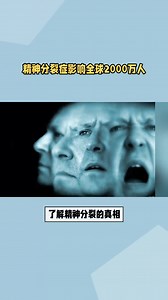 精神分裂症影响全球2000万人