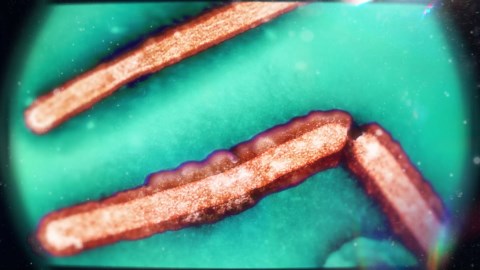 H5N1 under a microscope