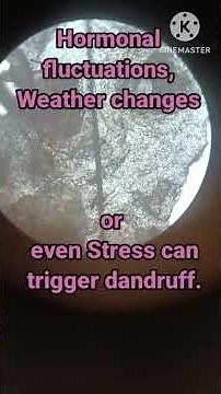 🔬Dandruff flakes | identifying under Microscope - Causes, Symptoms and Prevention #dandruff #biology