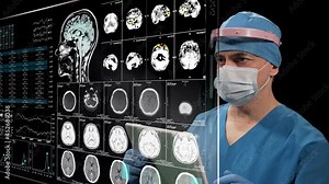 Brain MRI scan data