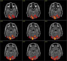 Approaches in Cognitive Psychology