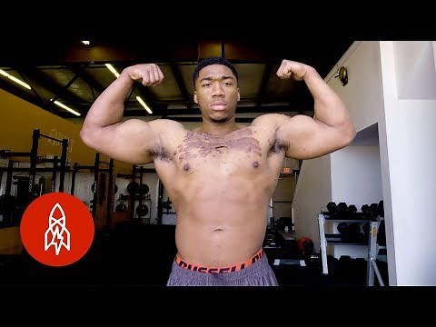 Scars Won’t Stop This Bodybuilder