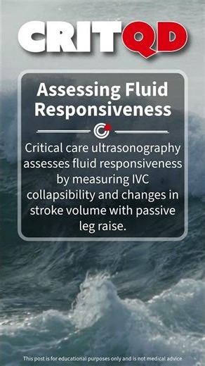 Assessing Fluid Responsiveness