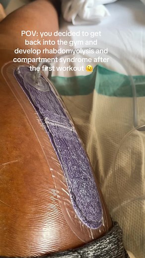 Gym Humor: Rhabdomyolysis and Compartment Syndrome
