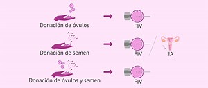 Reproducción asistida con donación de óvulos, semen y embriones