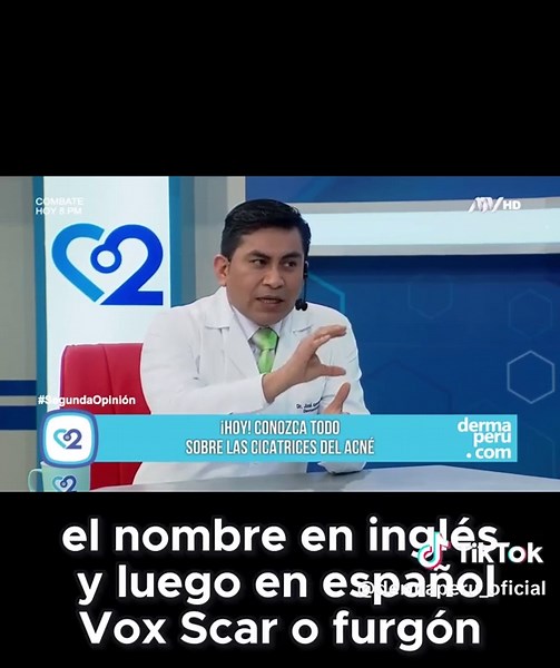 Tratamiento efectivo para cicatrices de acné