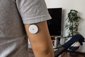 FreeStyle Libre: viví dos semanas con un sensor dentro de la piel que mide glucosa y envía los datos al smartphone por NFC