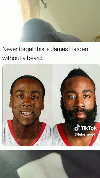 James Harden No Beard Transformation Explained