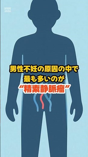 精索静脈瘤とは❓️受診の目安をわかりやすく解説【妊活まめ知識】