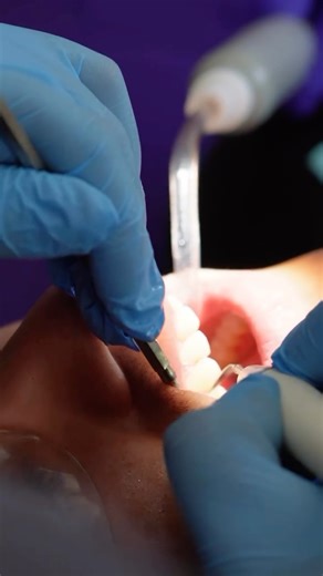 Clínica Odenta on Instagram: "Les presentamos al Dr. Genaro Zambrano, encargado del área de Rehabilitación Oral de nuestra clínica🦷 Encargado de devolver función, estética y confianza a cada sonrisa, a través de tratamientos integrales y personalizados. En Odenta creemos que una buena rehabilitación oral va mucho más allá de lo estético: se trata de bienestar, seguridad y salud a largo plazo✨ No dudes en consultar por nuestras horas disponibles directo a nuestro Whatsapp o por mensaje directo📲