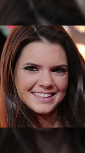 74K views · 104 reactions | How celebrities transformed before and after lip fillers | Bright Side | Facebook