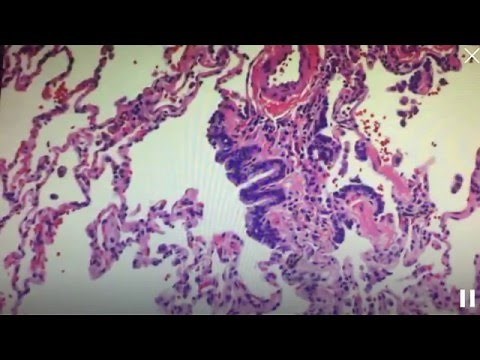Respiratory bronchiole (histology of the lung)