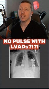 7.8K views · 41 reactions | No pulse with a LVAD?!?! How do we measure BP in these patients?? . Check out the ICU STARTER BUNDLE and the other Nurse Dose Cheat Sheets/Resources in the bio! . Follow for more ICU nursing education!  . #cvicu #cardiacnurse #criticalcare #nursingschool #icunurse #newgradnurse #newgradrn #nursesofinstagram #icunurselife #flightnurse #criticalcarenurse #emergencydepartment #nurselife #paramedic #ernurses | Nurse Dose Podcast | Facebook
