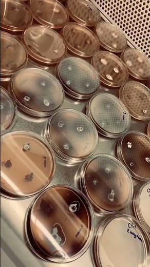 #microbiology #shorts #youtubeshorts #shortvideo #video #viral #labs #bacteria #fungus #microbes